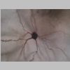 Neuronas Golgi 40.jpg